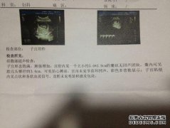 右肝无回声是什么意思？