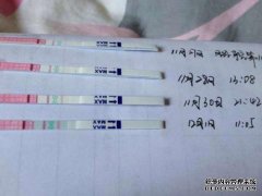 折叠排卵针和促进排卵针有区别吗？