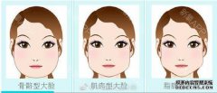 如何修脸