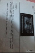 在子宫腔中，可见椭圆形妊娠囊的深色