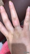 “在怀孕的第37周，一般的血液充血会发